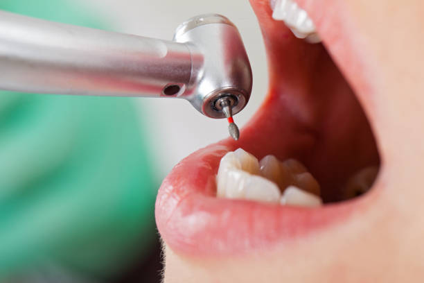 Best Emergency Treatment for Toothache in Crocker, WA